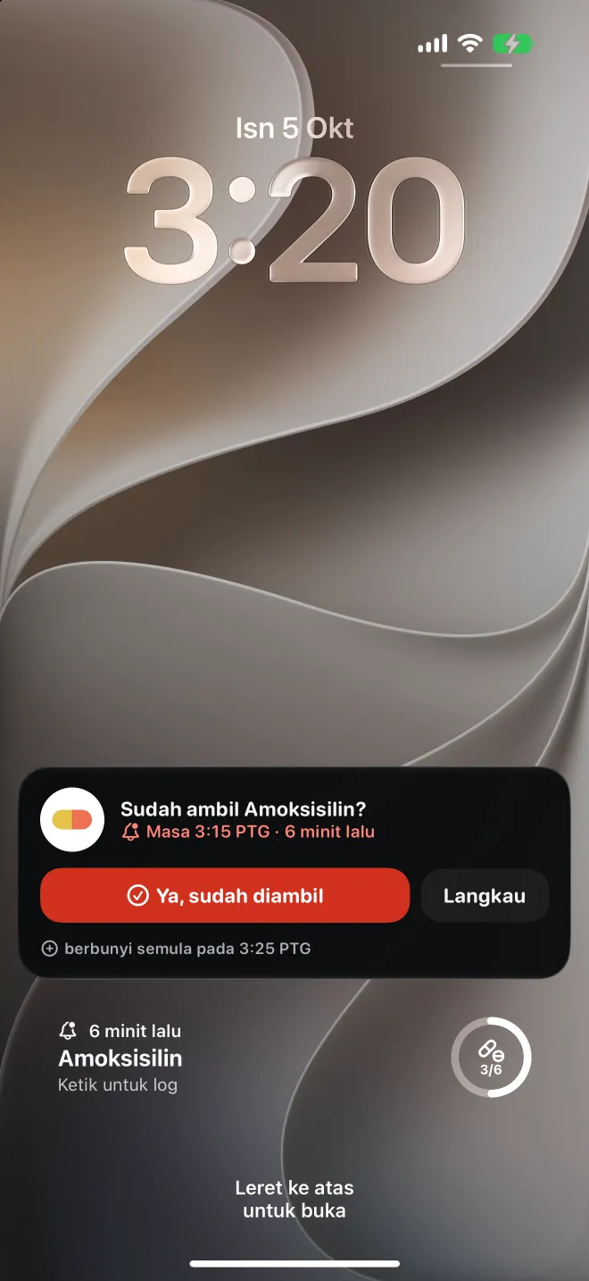Dos yang lewat pada Skrin Kunci iPhone, dengan butang untuk merekodkannya